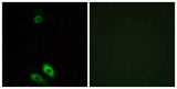 AKR1CL1 rabbit pAb