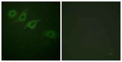IFN-γRα rabbit pAb