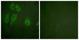 IL-2Rα rabbit pAb