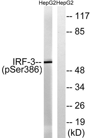 IRF-3 (phospho Ser386) rabbit pAb 50µL/100µL