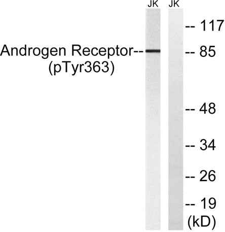 AR (phospho Tyr363) rabbit pAb