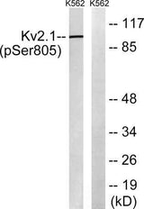 KV2.1 (phospho Ser805) rabbit pAb