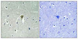 KIR6.2 (phospho Thr224) rabbit pAb