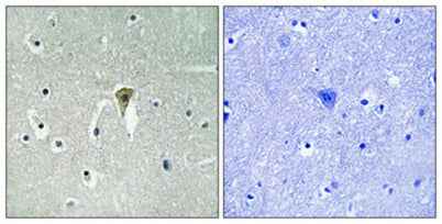 KIR6.2 (phospho Thr224) rabbit pAb