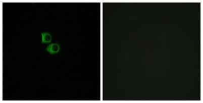 Olfactory receptor 51B6 rabbit pAb