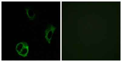 Olfactory receptor 51I1 rabbit pAb