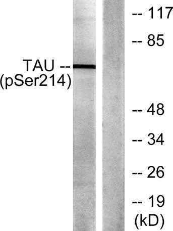 Tau (phospho Ser214) rabbit pAb