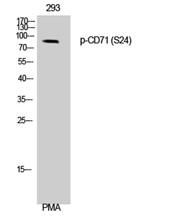 CD71/TfR (phospho Ser24) rabbit pAb 50µL/100µL