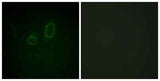 Moesin/Ezrin/Radixin (phospho Thr558) rabbit pAb