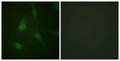 NFATc3 (phospho Ser165) rabbit pAb