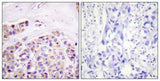 IκB-ε rabbit pAb