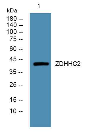 ZDHHC2 rabbit pAb