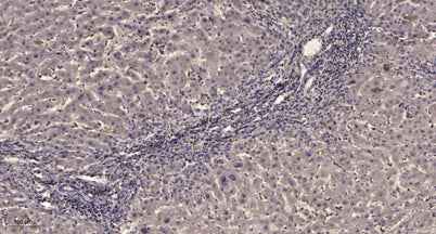 PDGFR-β (phospho Tyr771) rabbit pAb