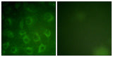 PDGFR-β rabbit pAb 50µL/100µL