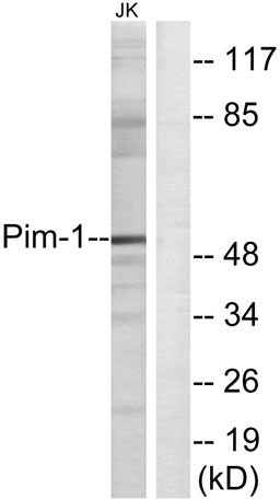 Pim-1 rabbit pAb