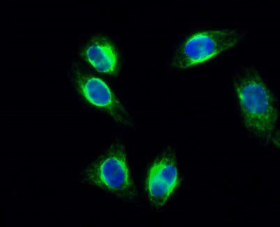 cPLA2 (phospho Ser505) rabbit pAb 50µL/100µL