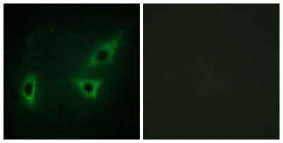 ATP7B rabbit pAb
