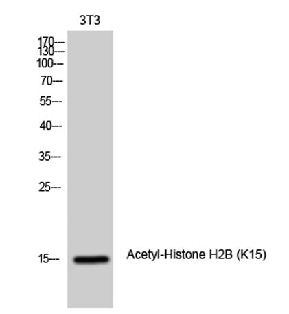 Histone H2B (Acetyl Lys15) rabbit pAb 50µL/100µL