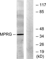 mPRγ rabbit pAb 50µL/100µL