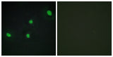 CdcA4 rabbit pAb 50µL/100µL
