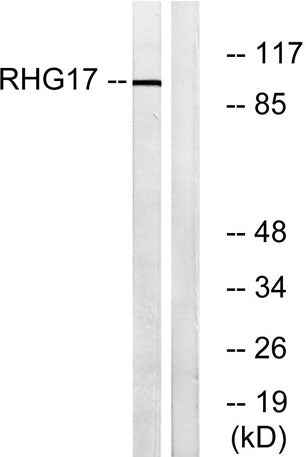 ARHGAP17 rabbit pAb