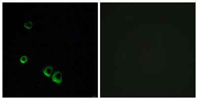 AVP Receptor V2 rabbit pAb