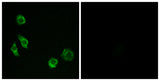 GPRC5D rabbit pAb 50µL/100µL
