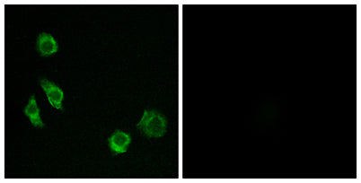 GPRC5D rabbit pAb 50µL/100µL