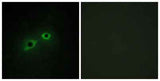 Enterokinase HC rabbit pAb