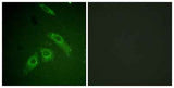 FAK (phospho Ser910) rabbit pAb