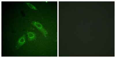 FAK (phospho Ser910) rabbit pAb