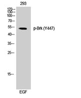 Brk (phospho Tyr447) rabbit pAb 50µL/100µL