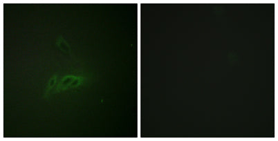 CD45 (phospho Ser1007) rabbit pAb 50µL/100µL