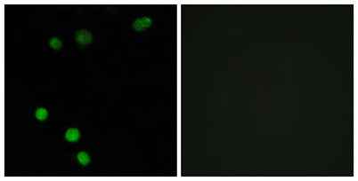 TP53INP2 rabbit pAb