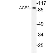 ACE2 rabbit pAb 50µL/100µL