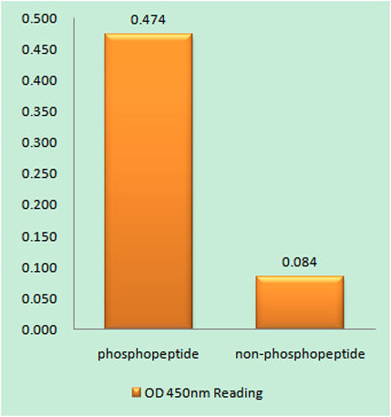 Ret (phospho Tyr1015) rabbit pAb 50µL/100µL