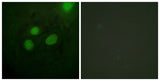 RPA32 rabbit pAb 50µL/100µL