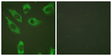 Ribosomal Protein S6 (phospho Ser240) rabbit pAb 50µL/100µL