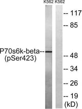 p70 S6 kinase β (phospho Ser423) rabbit pAb