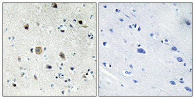 Ribosomal Protein S20 rabbit pAb 50µL/100µL