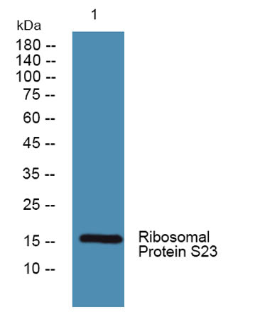 Ribosomal Protein S23 rabbit pAb 50µL/100µL