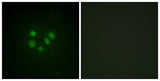 BLM rabbit pAb 50µL/100µL
