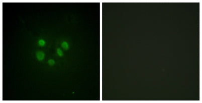 BLM rabbit pAb 50µL/100µL
