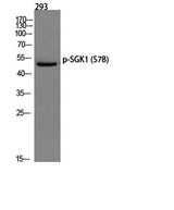 SGK1 (phospho Ser78) rabbit pAb