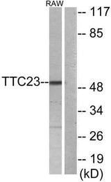 TTC23 rabbit pAb