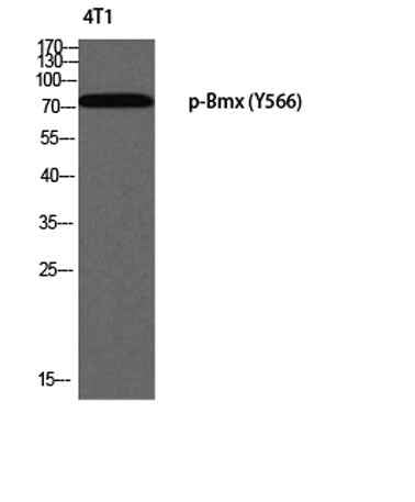 Bmx (phospho Tyr566) rabbit pAb