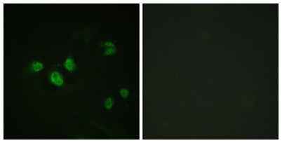 Sp1 (phospho Thr453) rabbit pAb