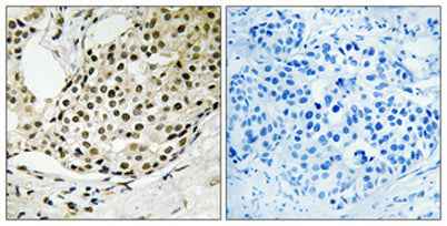 SSB (phospho Ser366) rabbit pAb