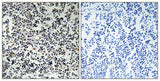 Thymidine Kinase rabbit pAb 50µL/100µL