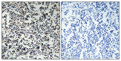 Thymidine Kinase rabbit pAb 50µL/100µL